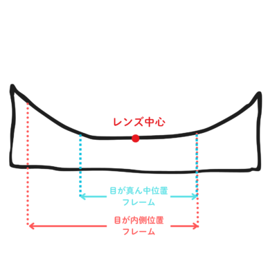 強度近視目の位置
